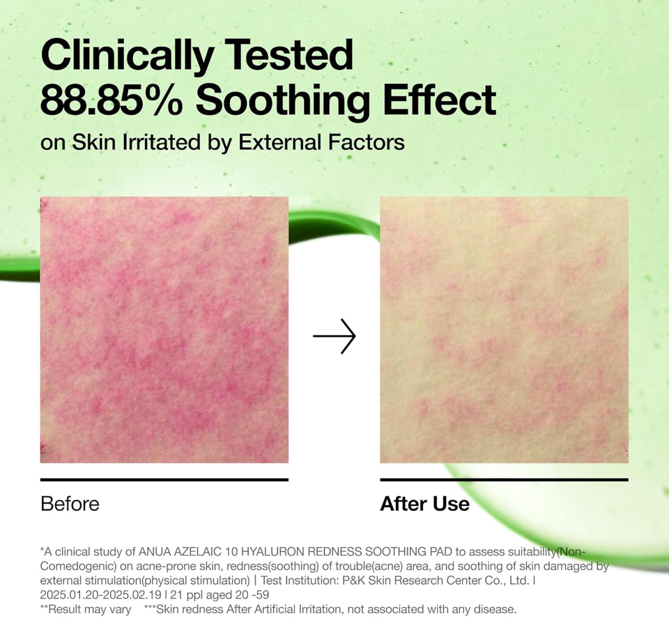 Anua Azelaic 10 Hyaluron Redness Soothing Pad, Troubled & Spot Care with Korean toner pads, Quick & Easy Stretchable Facial Mask with Azelaic acid, Hyaluronic Acid, Korean Skin Care (90 pads)
