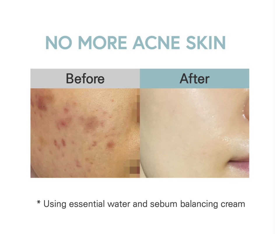 HYAAH Sebum Balancing Cream 50ml